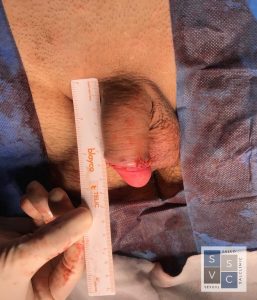 PHOTO 2019 10 05 14 27 34 2 1 257x300 Penis enlargement