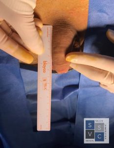 PHOTO 2019 10 05 14 27 34 4 233x300 Penis enlargement