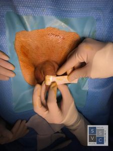 PHOTO 2019 10 26 14 48 04 1 768x1024 1 225x300 Penis enlargement