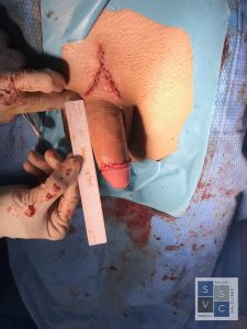 PHOTO 2019 10 26 14 49 13 1 768x1024 1 225x300 Penis enlargement