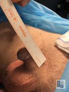 pene2 768x1024 1 225x300 Penis enlargement