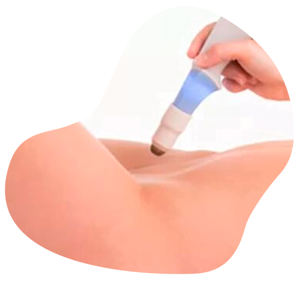 incontingencia Vaginal rejuvenation