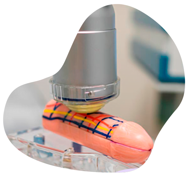 disfuncion2 600x600 1 Erectile dysfunction