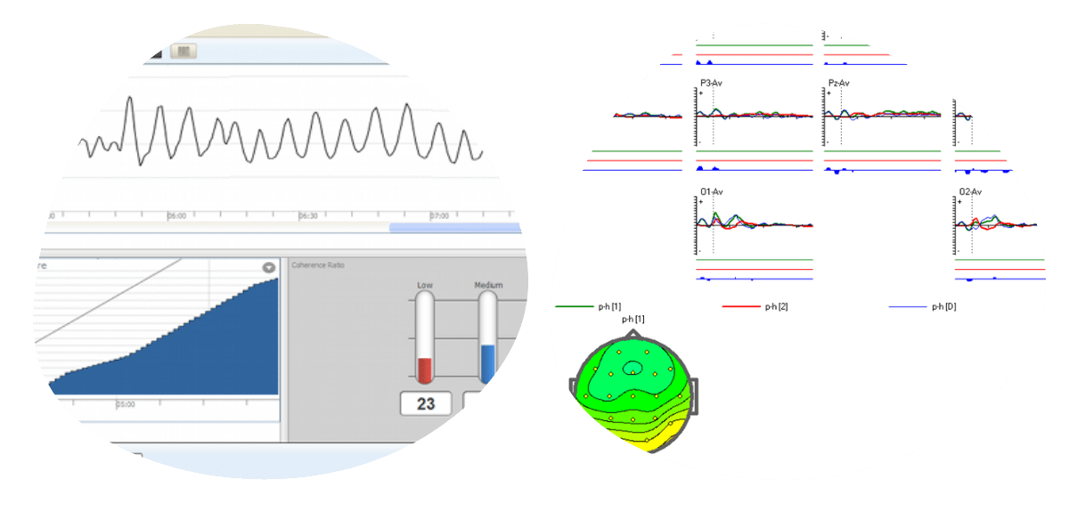 psicotek pantalla 24 1 Erectile dysfunction