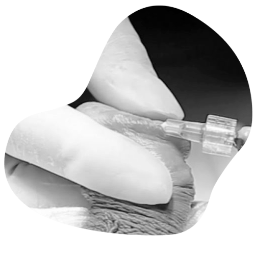 Relleno glande ppo8wue8ydtf72djb2apgnula7iyy1gpxkwl9q9w20 Premature ejaculation