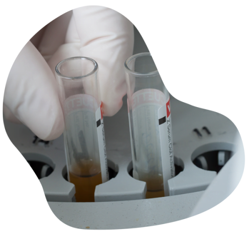 disfuncion5 600x600 1 ppodbkf5093holtlh67s03xofj79q2l036p9msxnd4 Erectile dysfunction