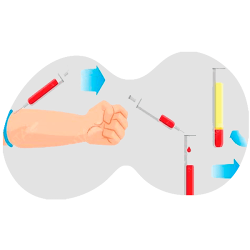 proceso plasma rico fibrina 1 ppo76b6sa67osz7jgj782xxmkdqvuy7l02gow0zs08 Curved penis