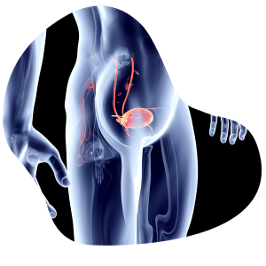 uroandrologia ppns48nej0m11qylm1k8hac8gw0p32r5kgag9itmt4 Treatments